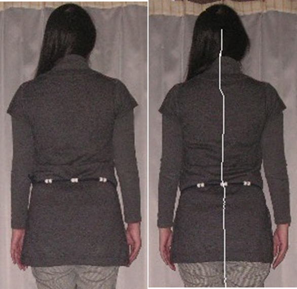 五十肩時の姿勢画像を細線化画像処理