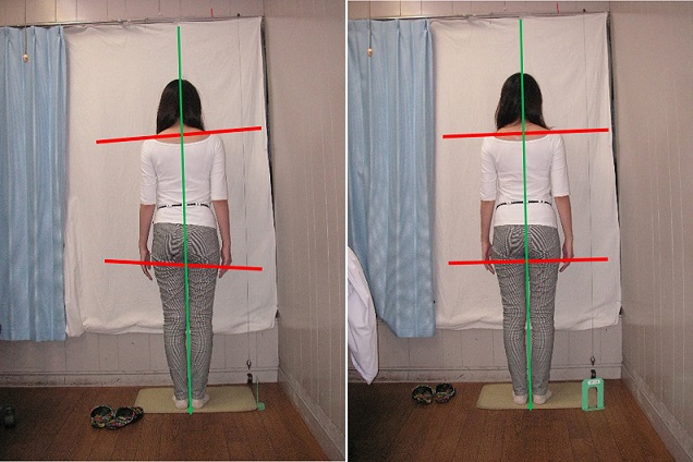 整体前後の姿勢画像の比較