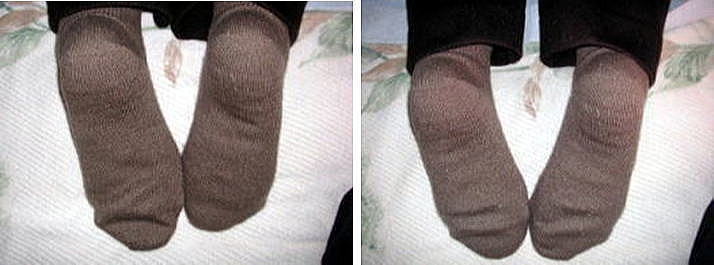 高齢の方の骨盤矯正効果。