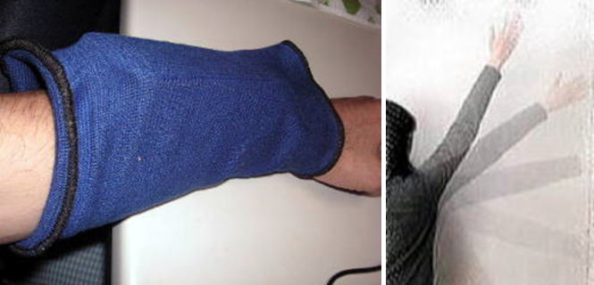 五十肩の可動域の測定。