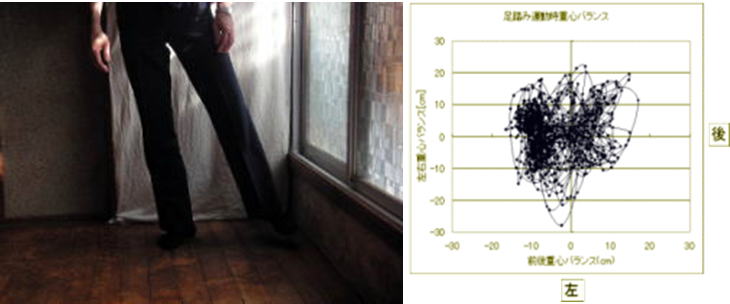 片足立ちの重心動揺の測定です。リハビリの現場で活用されています。