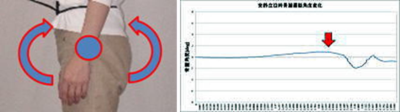 骨盤の微細な変化