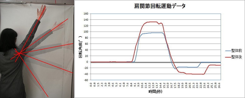 東京新宿区の方の五十肩運動の測定です。