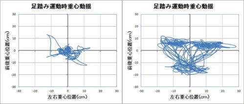 産後の腰痛の重心バランスです。
