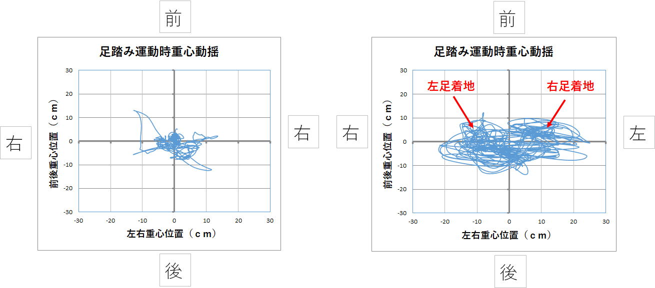 産後の腰痛が改善したデータ画像です。