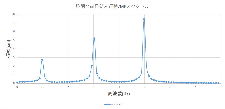 股関節痛をお持ちの方に多く見られるスペクトルです。