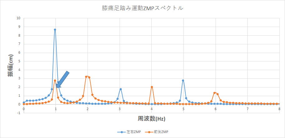 膝痛のあるスペクトル