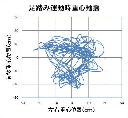 坐骨神経痛の重 心バランス図