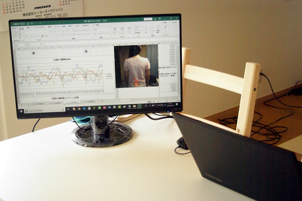 産後の腰痛やお尻の痛み分析