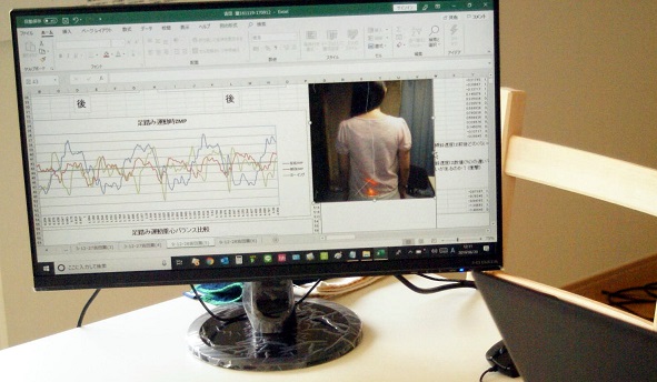 五十肩の状態をパソコンに入力